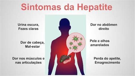 sintomas hepatite b - candidíase sintomas
